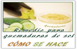 Remedio Casero Para Quemaduras Solares
